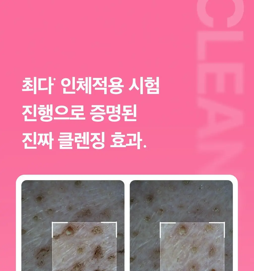 [3D진동클렌징/모공케어] 메디큐브 에이지알 부스터 진동 클렌저 헤드 (베이지/핑크) 상세페이지 24